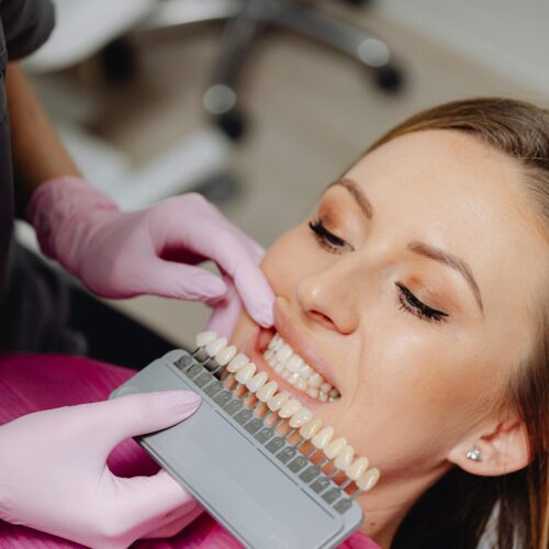 A woman undergoing a dental check-up with a shade guide to match teeth color in a dental clinic.